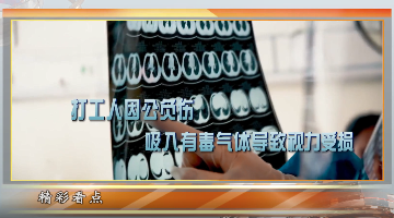 我的工傷誰負責